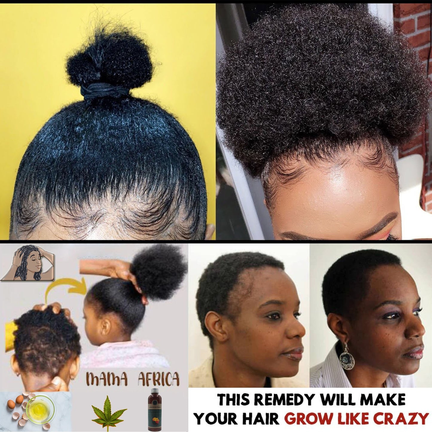 Africa Crazy Hair Growth Products Traction Alopecia Chebe Powder Hair Loss Treatment Regrow Your Edges Bald Spots Thinnin Hair