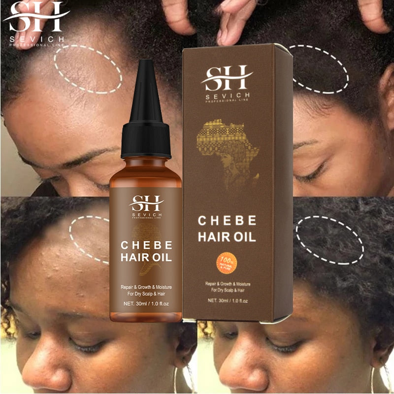 Fast Hair Growth Set Chebe Oil Traction Alopecia Hair Strengthen Mask Anti Break Loss New Africa Baldness Treatment Care Essence