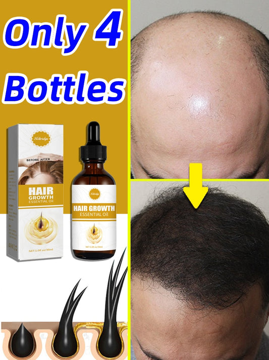 Hair Growth Regrowth Products Oil Anti Hair Loss