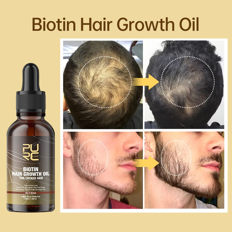 PURC Hair Growth Products Biotin Hair Oil Fast Regrowth Anti-Hair Loss Serum Thickener Scalp Treatment for Men Women Hair Care