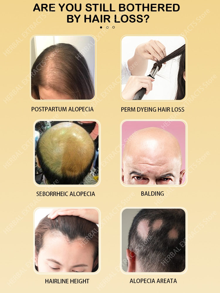 Hair Growth Regrowth Products Oil Anti Hair Loss