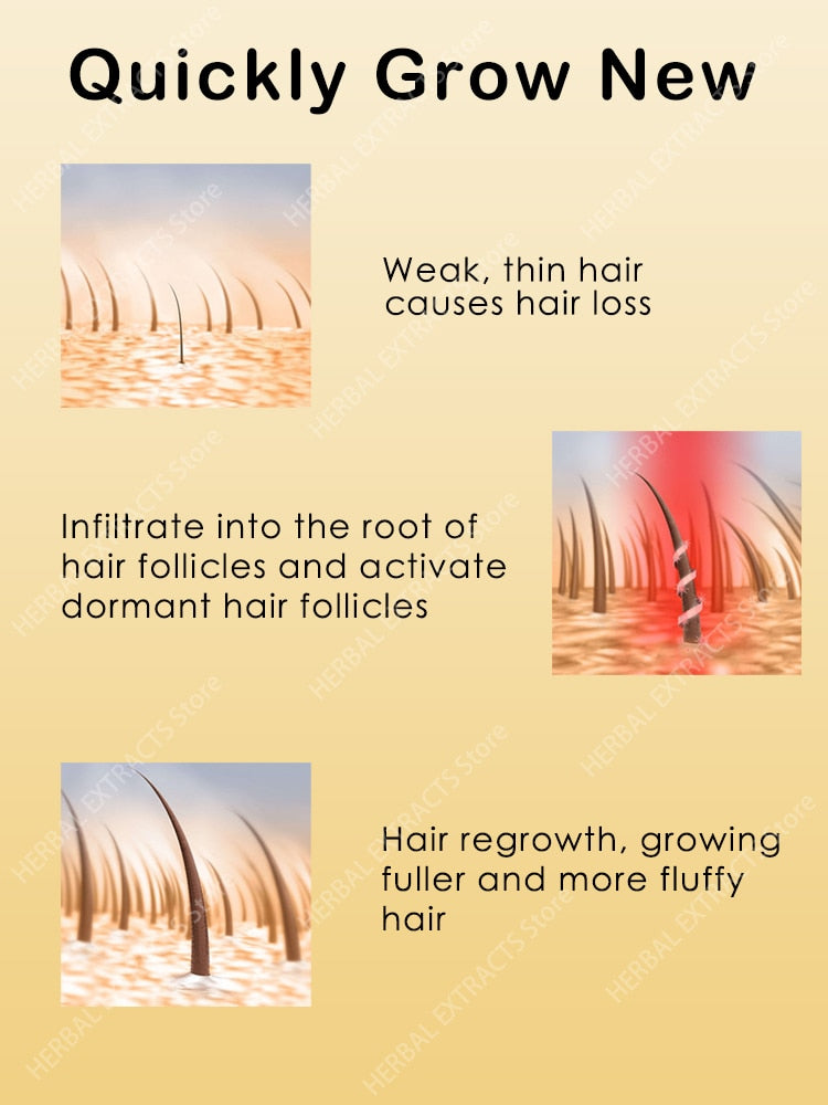 Hair Growth Regrowth Products Oil Anti Hair Loss