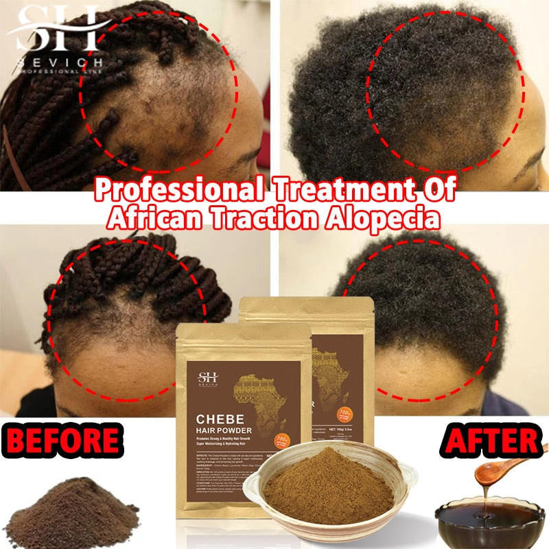 2023 New 100g Chebe Powder Africa Women Traction Alopecia Treatment Oil Men Hair Growth Spray Hair Loss Treatment Get Rid Of Wig